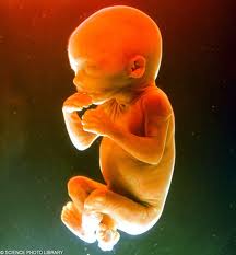 20_foetuses