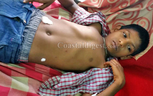 Blore gilatin blast 2 1