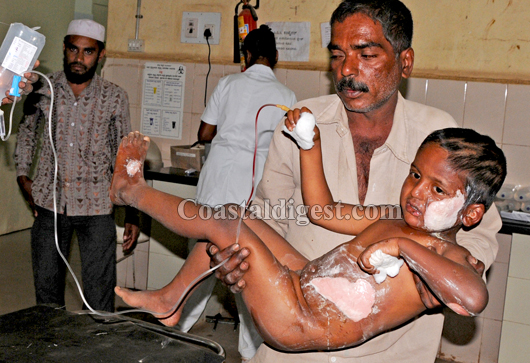 Cylinder explosion tmukur4