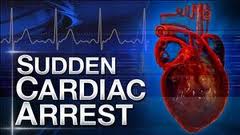 cardiac_arrest