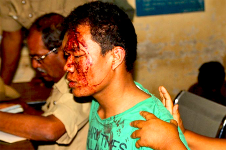 Manipur student beaten