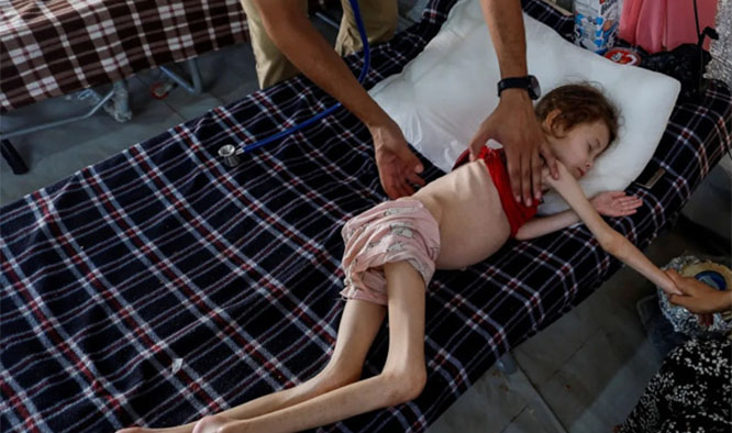 starving.jpg starving.jpg